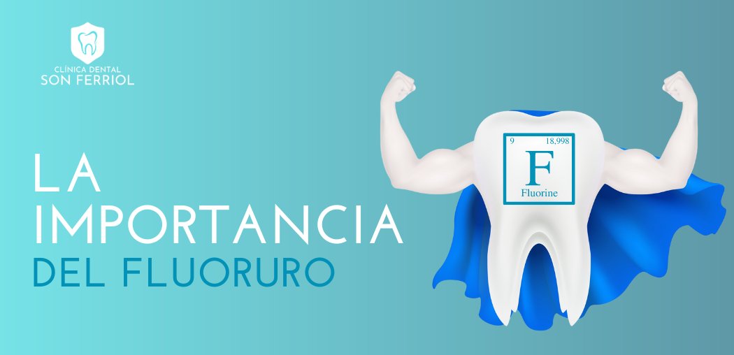 La Importancia del Fluoruro en la Prevención de Caries Dentales