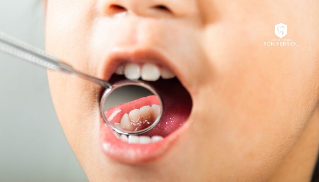 cuidado dental en la infancia
