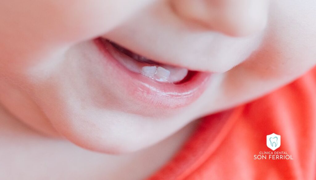 erupción de los primeros dientes de un bebe