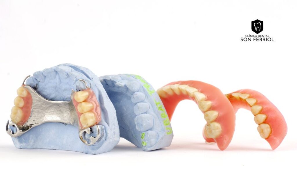 prótesis dentales