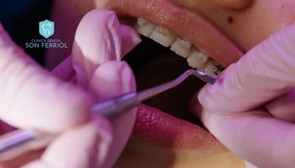 revisión dental a un adolescente con brackets