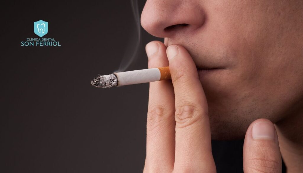 el tabaquismo un factor de riesgo para las encías