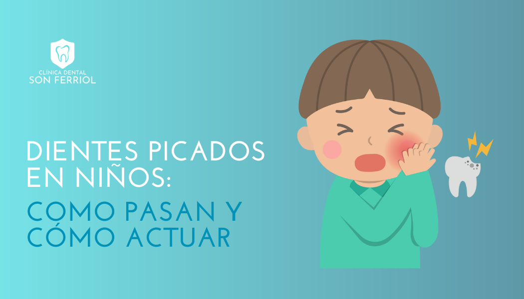 Dientes Picados En Ni os Como Pasan Y C mo Actuar dientes-picados-en-ni-os-como-pasan-y-c-mo-actuar