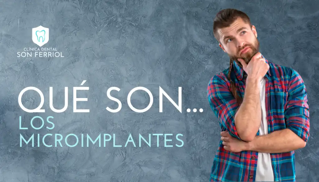 microimplantes dentales